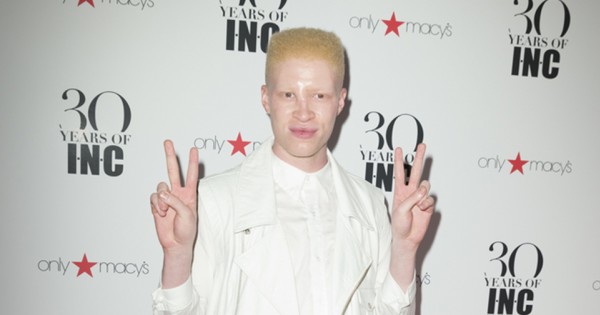 הדוגמן שהפך את מחלות העור לטרנד האופנה הלוהט