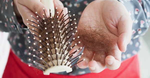 התקרחות נשית: רק בת 34 וכבר מתחילה להקריח