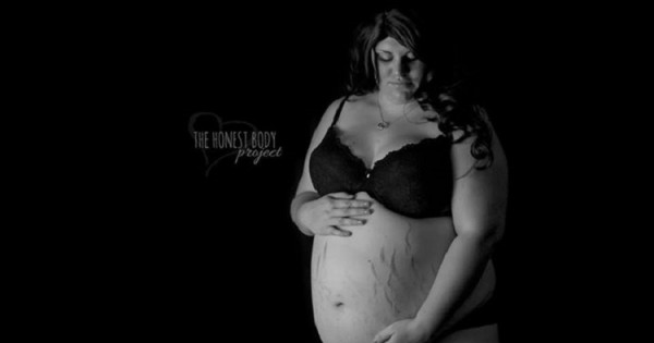 הפאט שיימינג מגיע גם לנשים בהיריון