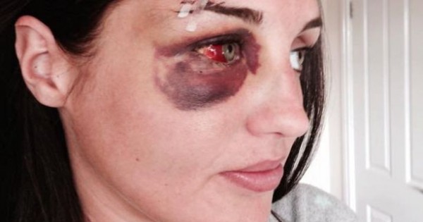 סיפור מזעזע ופיקטיבי לחלוטין: אישה מוכה שנרצחה על ידי בעלה