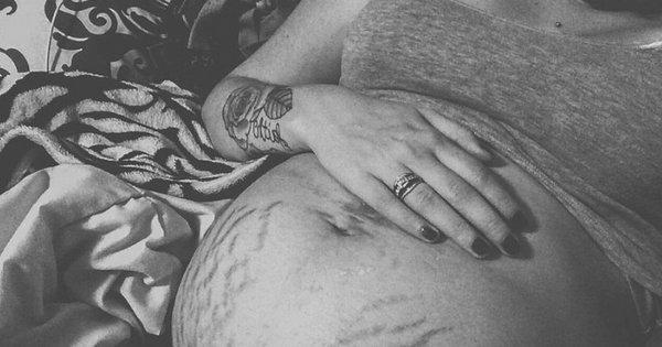 קמפיין חדש מנסה לגרום לנו לאהוב את סמני המתיחה