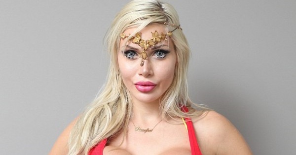 הסירה צלעות רק כדי להצר את המותניים