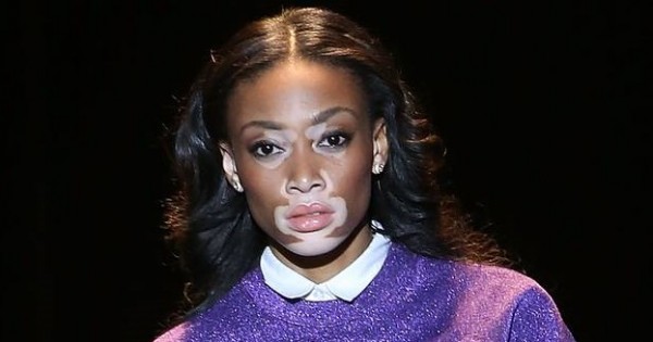 הדוגמנית הכי אותנטית כובשת את שבוע האופנה