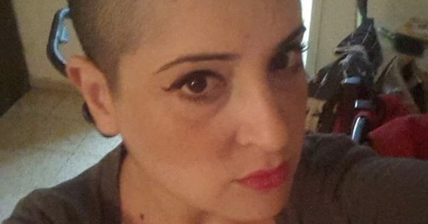 קירחות: הנשים שגילחו את שיער ראשן מבחירה