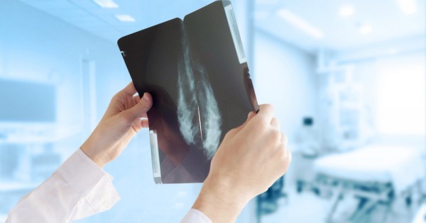 פיתוח רפואי חדש: תוכנה שמזהה סרטן שד פי 30 מהר יותר מרופא