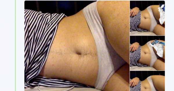 האישה שלא מתביישת בשיער הגוף שלה