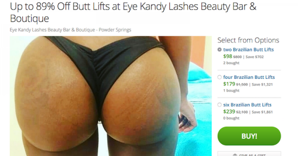 הקופון הכי ביזאר: עיצוב ישבן במבצע