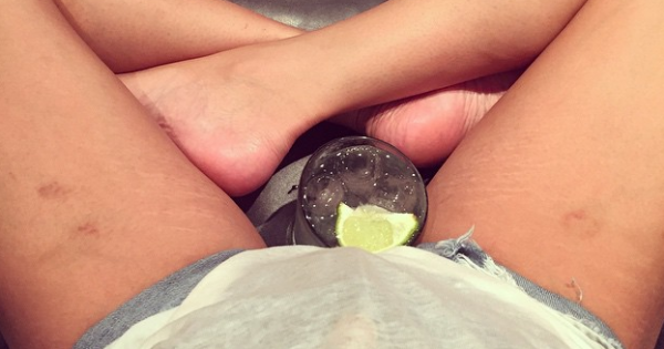 תמונת היום: גם לדוגמנית-על יש סימני מתיחה