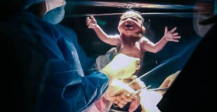 חדש: לידות קיסריות מאחורי וילון שקוף