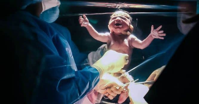 חדש: לידות קיסריות מאחורי וילון שקוף