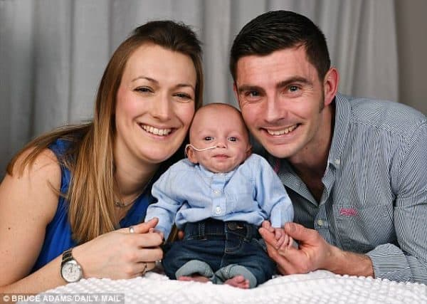 פג שנולד בשבוע 28