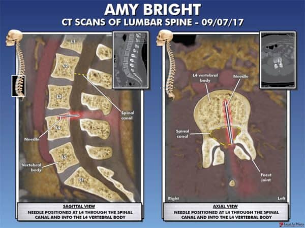 צילום ה-CT של איימי ברייט