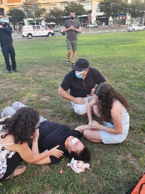  רונית ברק מיד אחרי התקיפה. צילום דב שמש