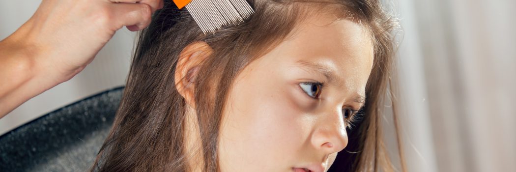 ראש בראש: נותנים מכת מחץ לכינים