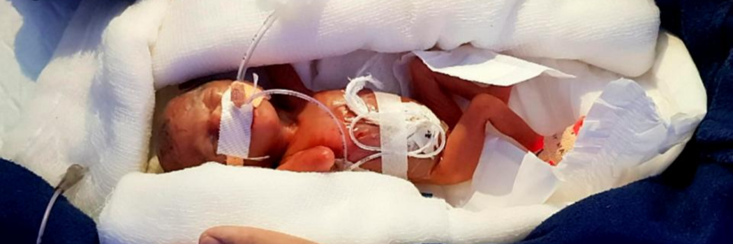 התינוקת הקטנה ביותר שנולדה באסיה משתחררת מבית החולים