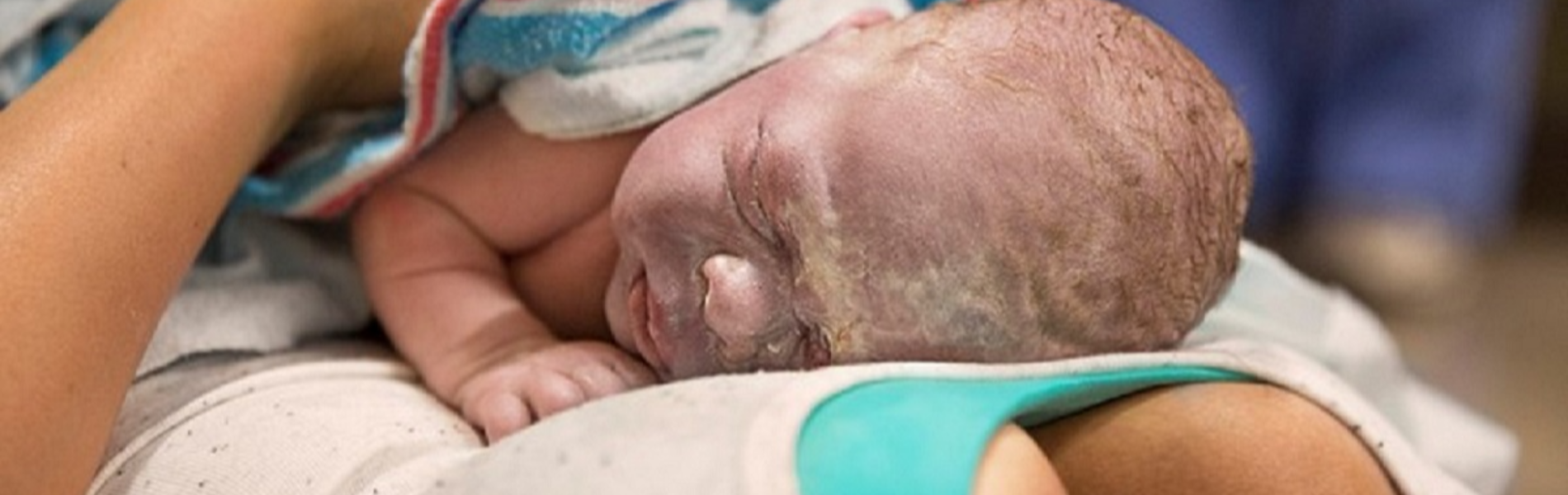 תמונות הלידה הנדירה שריגשו את הרשת