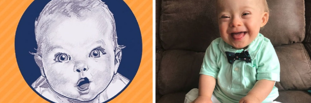 תינוק השנה של גרבר עם תסמונת דאון