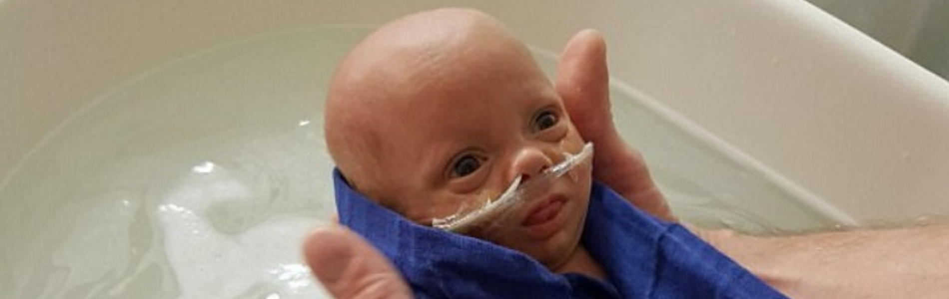 יומן המסע המרגש של אמא לפג שנולד בשבוע 28