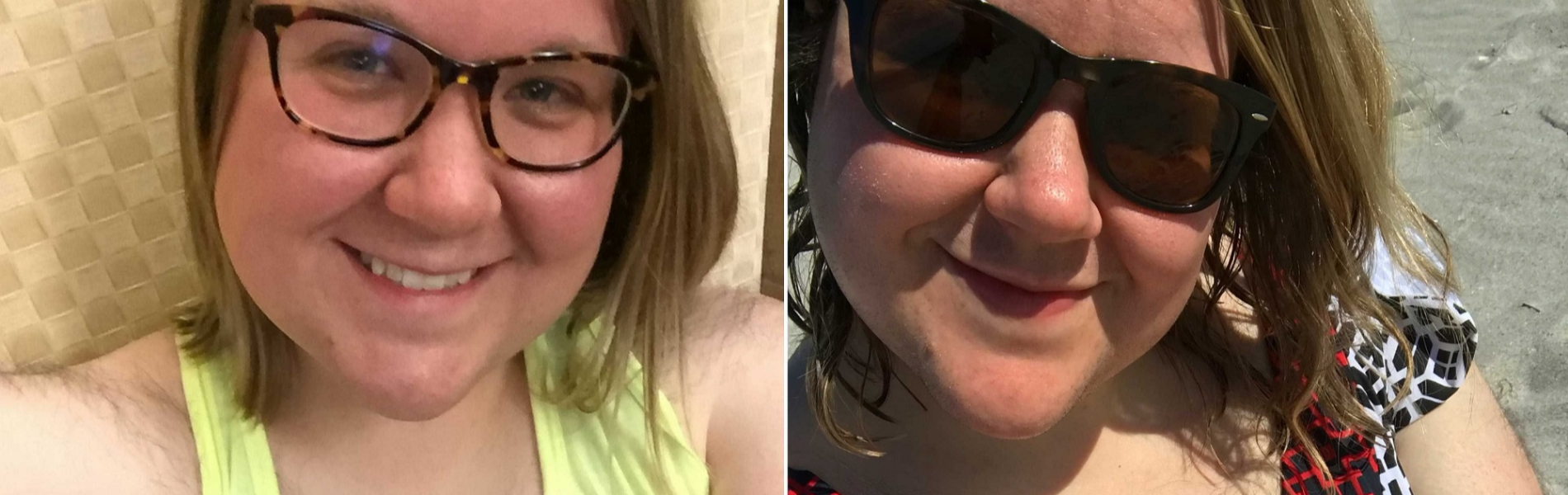 שחלות פוליציסטיות: כך למדתי לקבל ולחבב את שיעור היתר שלי