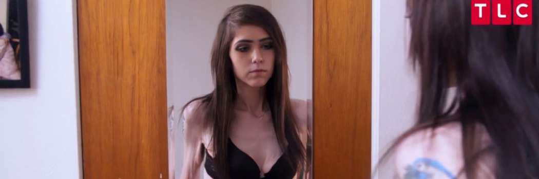 צעירה סוחבת קילוגרמים של עודפי עור שהרופאים מסרבים להסיר