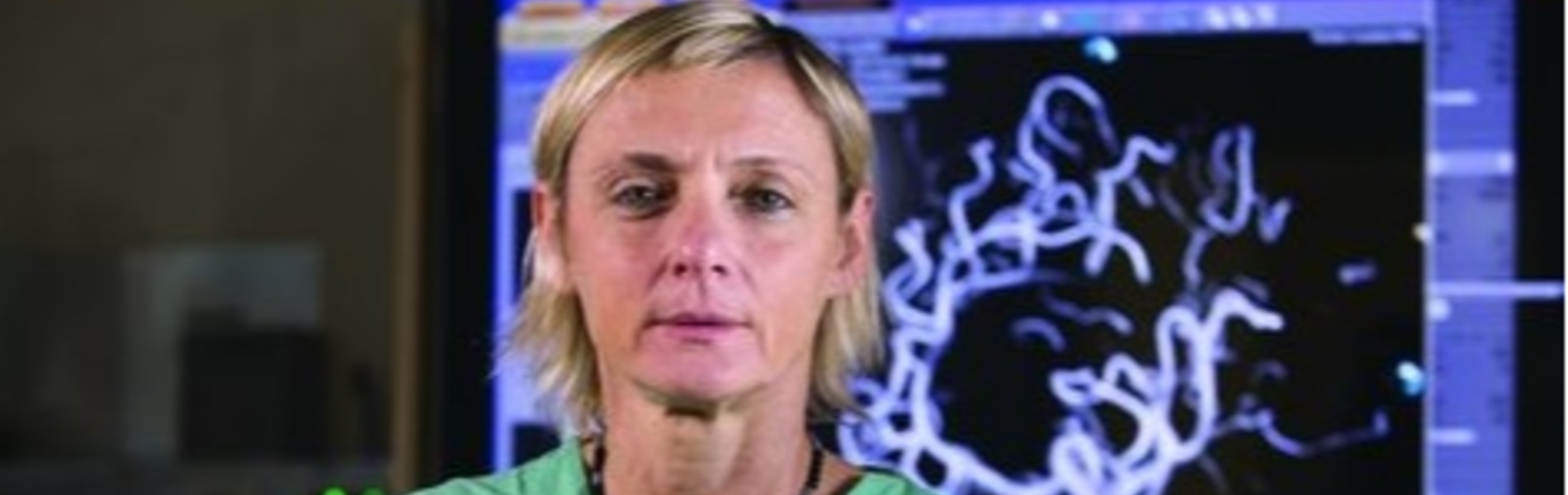 הכירו את מצנתרות המוח שחולשות על חצי מדינה