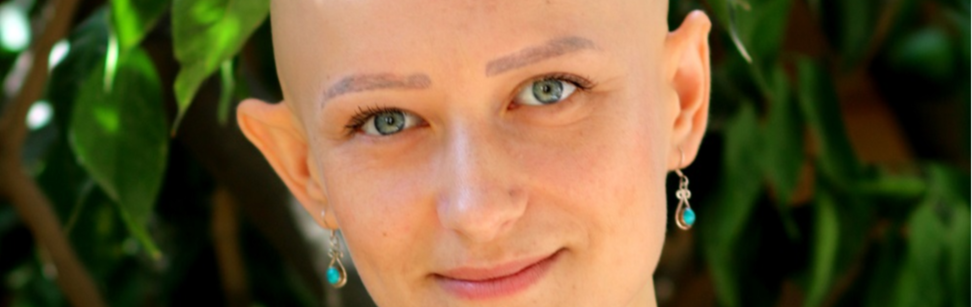 "אני כבר לא מתביישת לדבר על זה שאני קירחת"