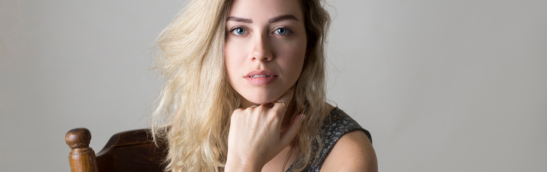 זו הצלקת שלי ואני לא מתביישת בה יותר