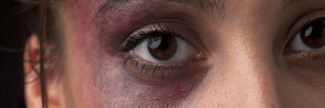 האם 'צדק מאחה' עבור נפגעות תקיפה מינית יגדיל את מספר המתלוננות?