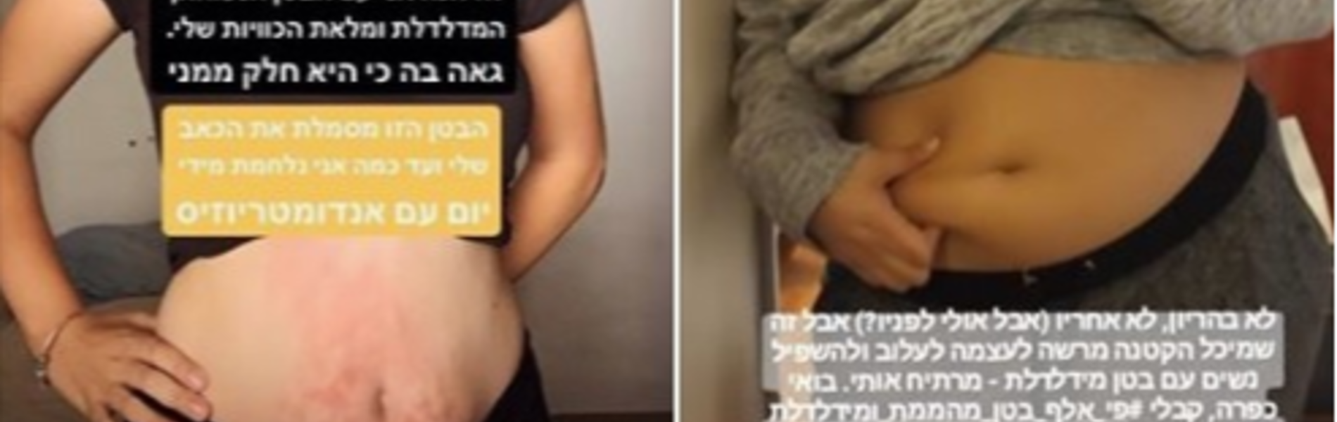 מחאת רשת נגד מיכל הקטנה: "תפסיקי להקטין נשים אחרות!"