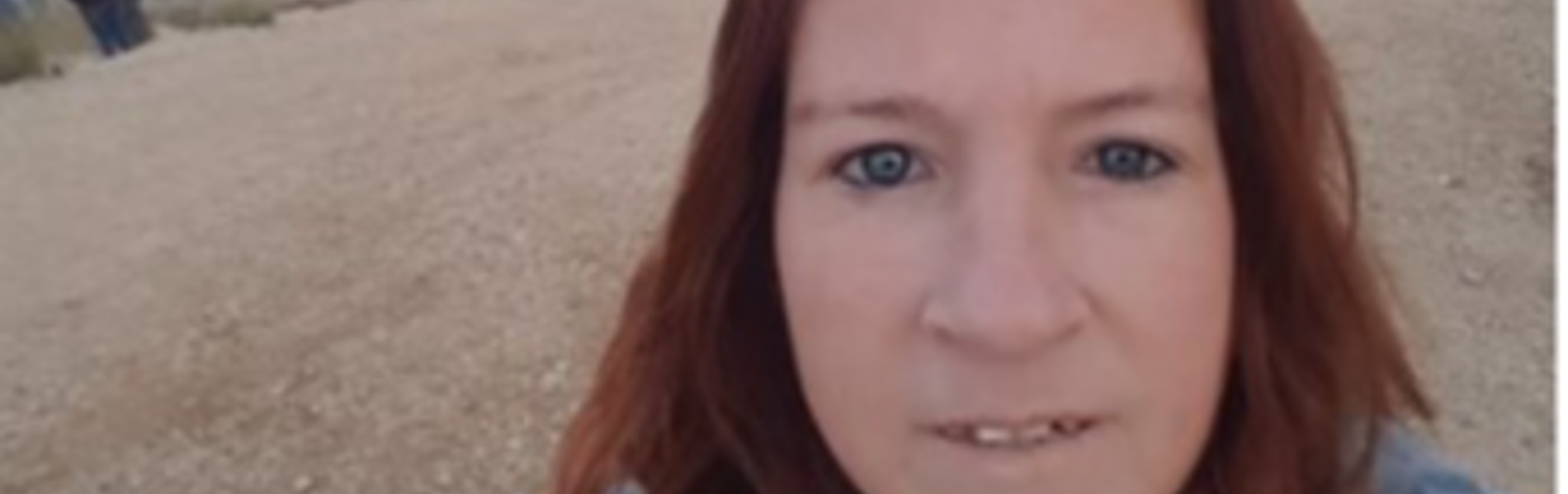 אני לא אישה היסטרית – יש לי סקלרודרמה