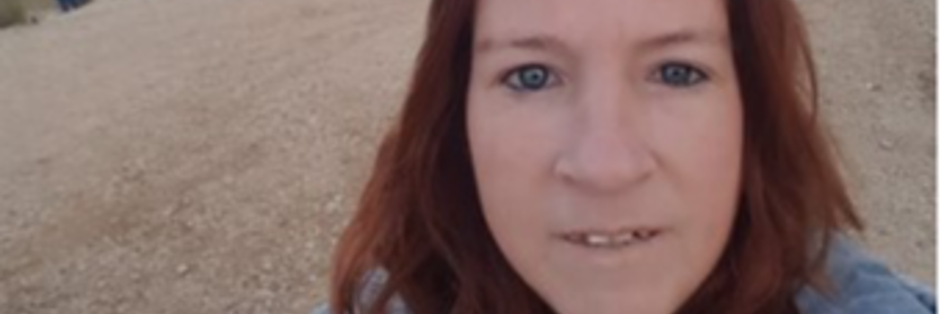 אני לא אישה היסטרית – יש לי סקלרודרמה